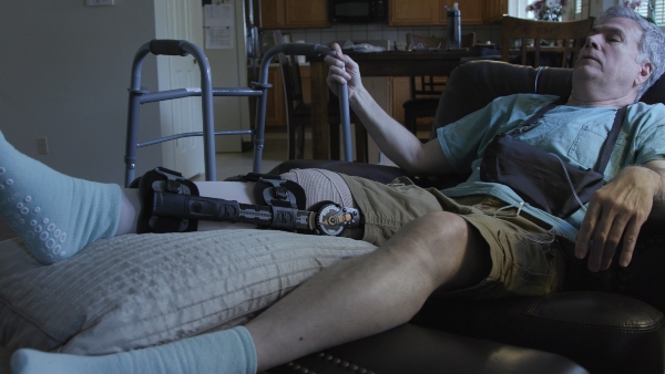 A man rests on a recliner chair while elevating his leg that has a brace and bandages on it. He is recovering at home through outpatient home care after a surgery.